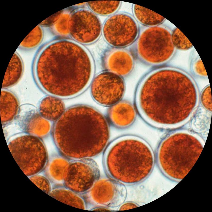 Micro-algae biomass under a microscope